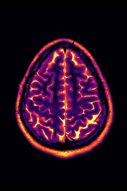 Conclusion: Stable Disease backdrop