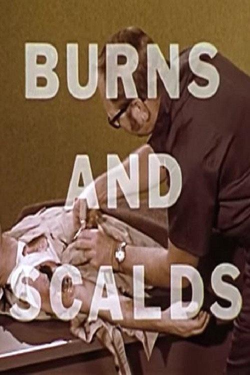 Burns And Scalds backdrop